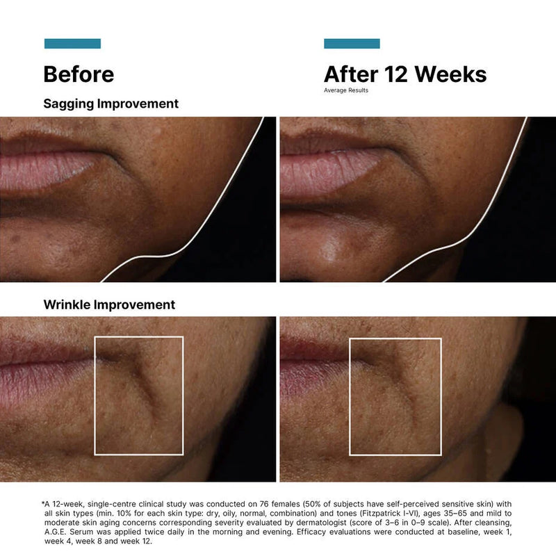 A.G.E. Ultra Serum
